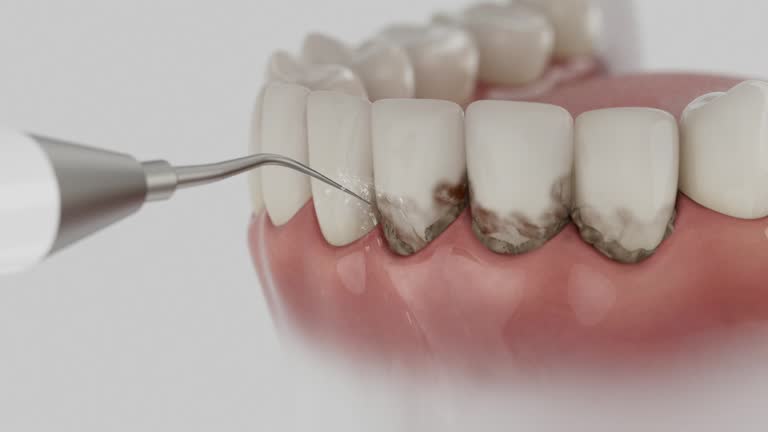 Trusted Tooth Extraction service in Beverly Hills, TX - Dentist Open Now
